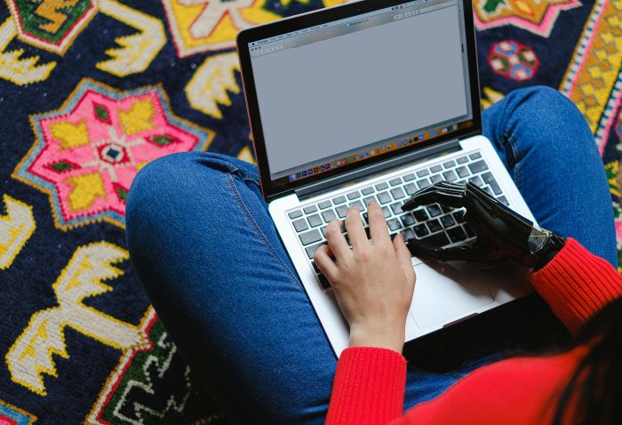 Eine Frau sitzt im Schneidersitz mit einem Laptop auf den Beinen. Ihre linke Hand ist eine bionische Version.